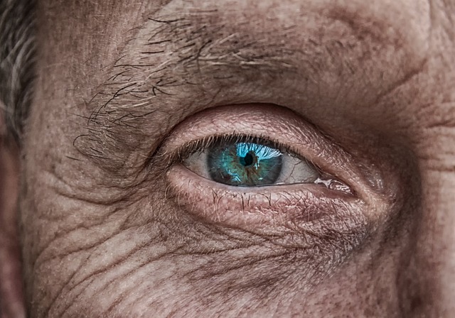 Rozpoznawanie i leczenie zmian guzkowatych na powierzchni oka: przewodnik dla pacjentów