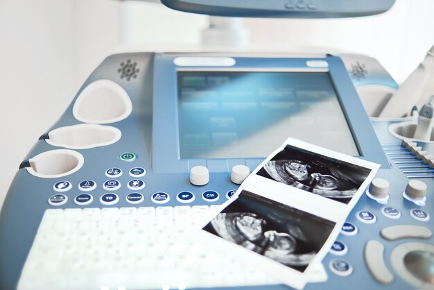 Innowacyjne podejście do badań prenatalnych w nowoczesnych centrach medycznych